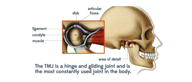 TMJ -Temporomandibular Joint